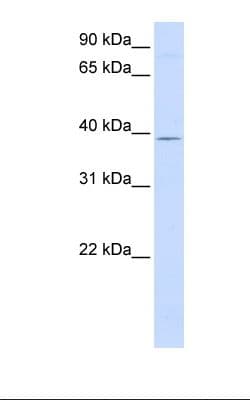 Polyclonal Rabbit anti-Human GTPBP10 Antibody (aa254-303, IHC, WB)