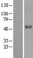 GC / Vitamin D-Binding Protein (Over-Expression Lysate Myc-DDK (Flag))