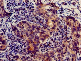 SLC4A9 / AE4 Antibody