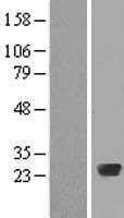 RAB20 Protein (Over-Expression Lysate Myc-DDK (Flag))