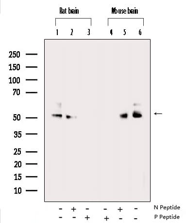 Polyclonal Rabbit anti-Human CAMK2A / CaMKII Alpha Antibody (phospho-Thr305, IHC, IF, WB)
