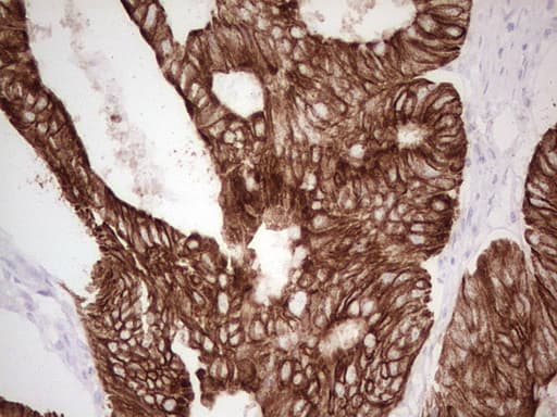 Monoclonal Mouse anti-Human ABCB1 / MDR1 / P Glycoprotein Antibody (clone OTI11D2, aa995-1280, IHC)