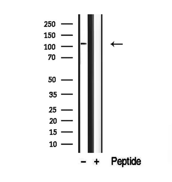 DAAM1 Antibody