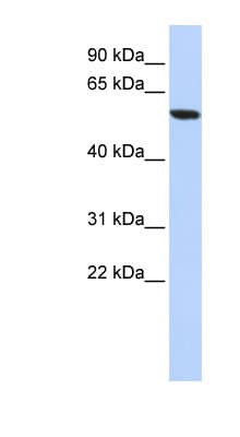 Polyclonal Rabbit anti-Human ZNF248 Antibody (aa108-157, WB)