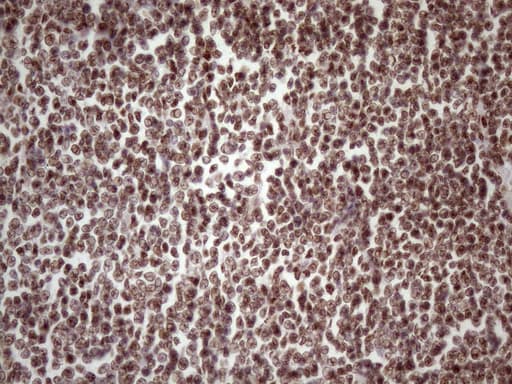 TP53BP1 / 53BP1 Antibody (aa1-300, clone OTI2H6)