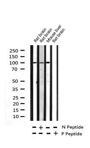 Polyclonal Rabbit anti-Human ATP1A1 Antibody (phospho-Ser16, IHC, IF, WB)