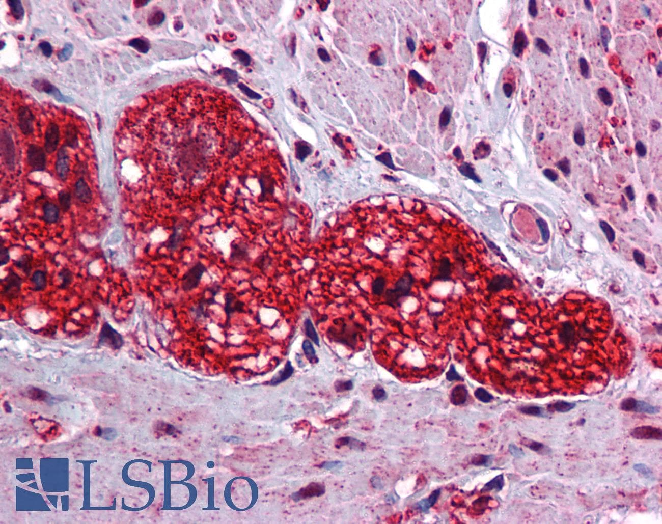 Polyclonal Rabbit anti-Human SOX6 Antibody (C-Terminus, IHC, WB)