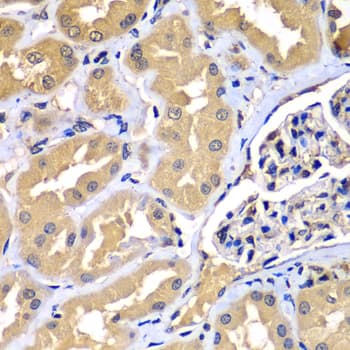 WIPI2 Antibody