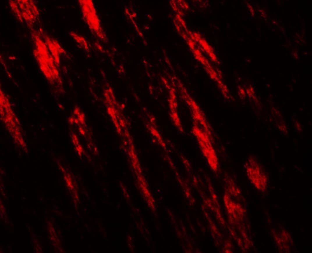 PJA1 / PRAJA1 Antibody