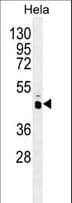 PRKAG1 / AMPK Gamma 1 Antibody (aa1-30)