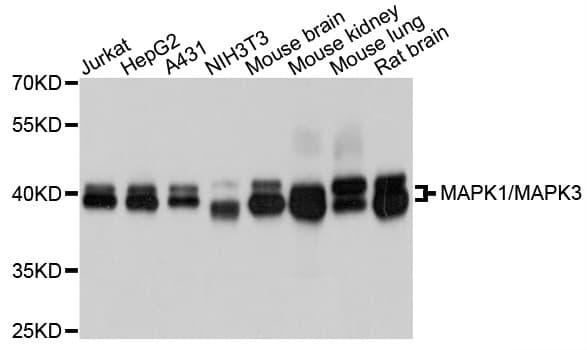 Monoclonal Mouse anti-Human ERK1 + ERK2 Antibody (IHC, WB)