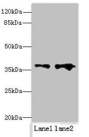 Polyclonal Rabbit anti-Human RPRD1B Antibody (IHC, WB)