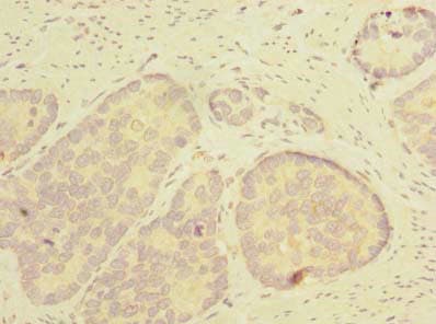 THTPA Antibody