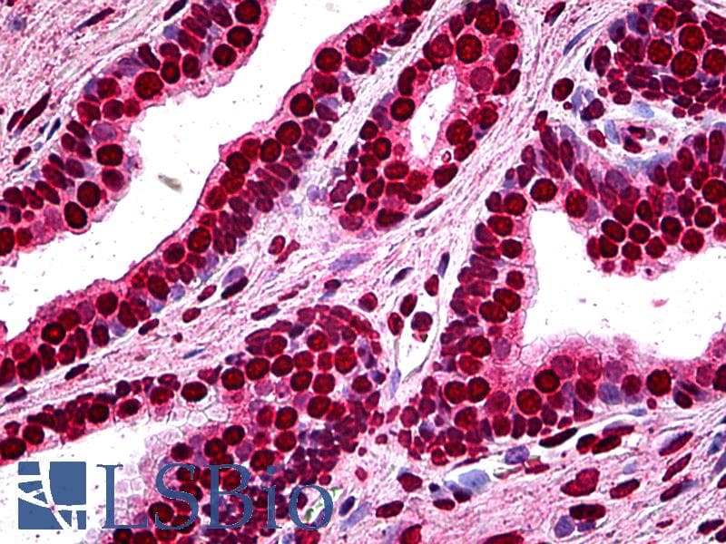 IHC-plus™ MEF2A / MEF2 Antibody (clone 3F6)