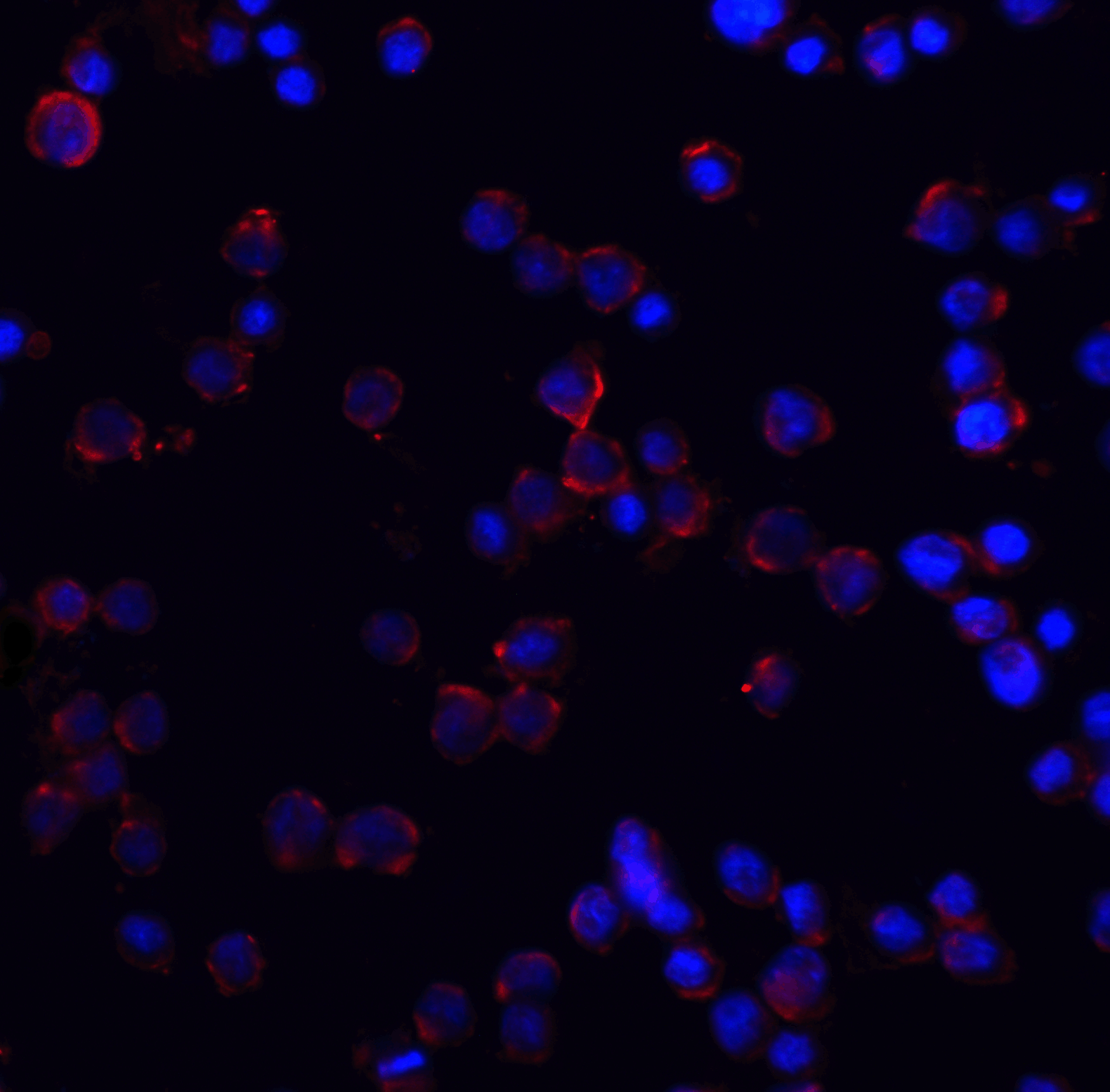 IHC-plus™ Polyclonal Rabbit anti-Human TNFRSF10A / DR4 Antibody (IHC, IF, WB)