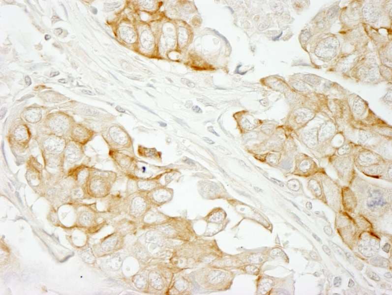 NOTCH2 Antibody (aa2421-2471)