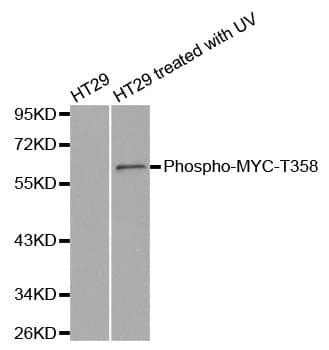 Polyclonal Rabbit anti-Human MYC / c-Myc Antibody (phospho-Thr358, WB)
