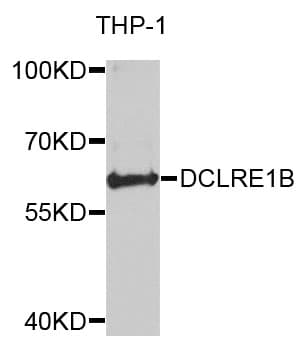 Polyclonal Rabbit anti-Human DCLRE1B Antibody (WB)