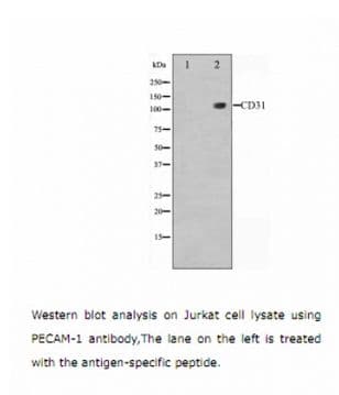 Polyclonal Rabbit anti-Human PECAM-1 / CD31 Antibody (IHC, IF, WB)