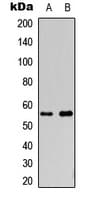 CYP2S1 Antibody (Internal)