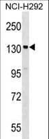 SIPA1 Antibody (aa942-970)