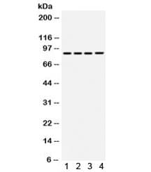 TGFBR2 Antibody