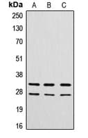 Polyclonal Rabbit anti-Human CTSG / Cathepsin G Antibody (N-Terminus, WB)