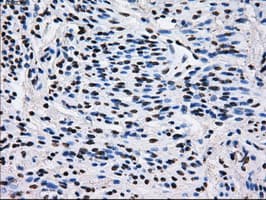 Monoclonal Mouse anti-Human L1CAM Antibody (clone OTI4F4, IHC, IF, WB)