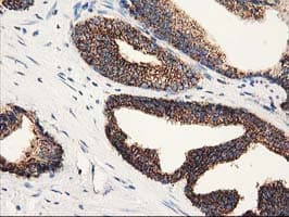 CLPP Antibody (clone OTI1C7)