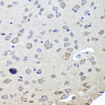 Polyclonal Rabbit anti-Human CHRNB2 Antibody (IHC, WB)