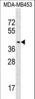 PSG9 Antibody (aa111-139)