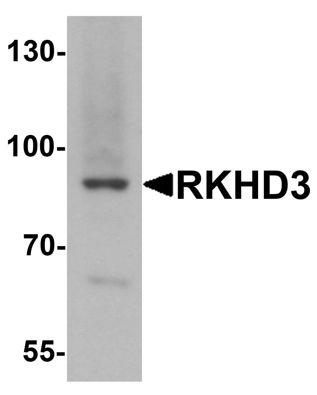 Polyclonal Rabbit anti-Human MEX3B / RKHD3 Antibody (IF, WB)