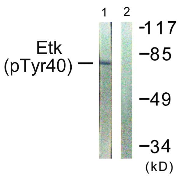 ETK / BMX Antibody (phospho-Tyr40)
