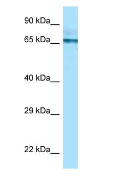 PGM2 Antibody (aa517-566)
