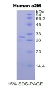 Human A2M / Alpha-2-Macroglobulin Protein (Recombinant His)