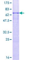 Human NDN / Necdin Protein (Recombinant GST)