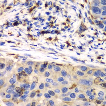 S100A8 / MRP8 Antibody