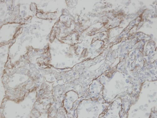 Polyclonal Rabbit anti-Human CLIC3 Antibody (aa1-236, IHC, WB)
