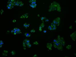 IHC-plus™ Monoclonal Mouse anti-Human MCL1 / MCL 1 Antibody (clone 2E11, IHC, IF, WB)