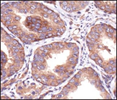 IGF1R / IGF1 Receptor Antibody (C-Terminus)