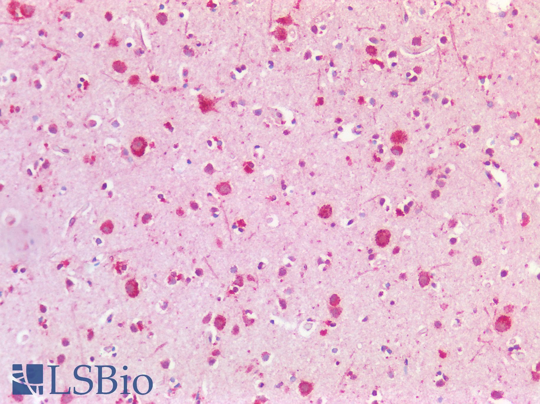 PathPlus™ Polyclonal Rabbit anti-Human APBA3 / MINT3 Antibody (aa352-401, IHC, WB)