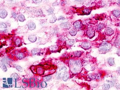 PathPlus™ Polyclonal Rabbit anti-Human GPR21 Antibody (Cytoplasmic Domain, IHC)