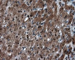 LTA4H / LTA4 Antibody (clone OTI7D11)