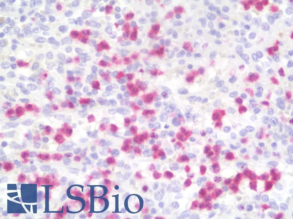 IHC-plus™ Calprotectin Antibody (clone MAC387)
