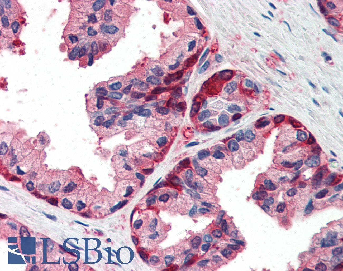 IHC-plus™ GSTP1 / GST Pi Antibody (aa22-33)