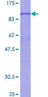 Human PTGS2 / COX2 / COX-2 Protein (Recombinant GST)