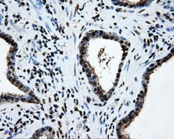 SORD / Sorbitol Dehydrogenase Antibody (clone OTI15H2)