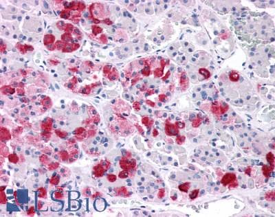 PathPlus™ CRHR2 / CRF2 Receptor Antibody (N-Terminus)