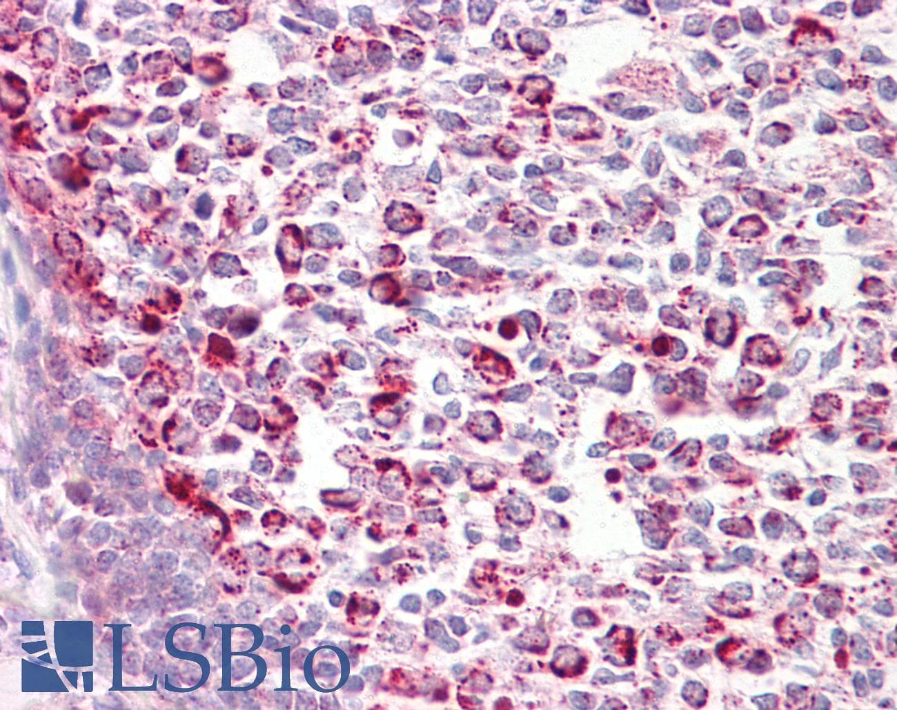 IHC-plus™ Polyclonal Rabbit anti-Human CASP6 / Caspase 6 Antibody (aa130-179, IHC, WB)
