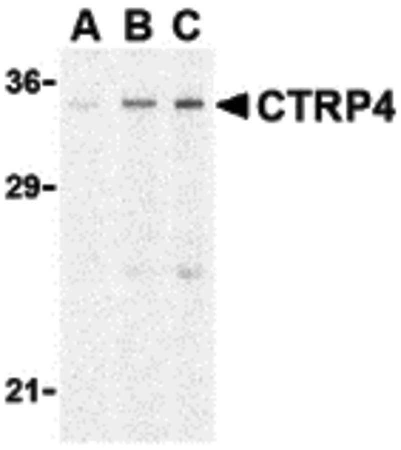 IHC-plus™ Polyclonal Rabbit anti-Human C1QTNF4 / CTRP4 Antibody (IHC, IF, WB)